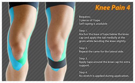 Kt Tape Knee Replacement