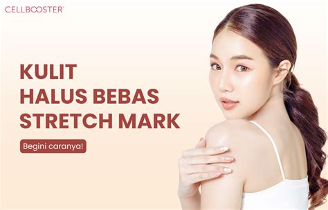 Kulit Bebas Stretch Mark