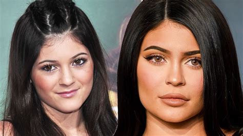 Kylie Jenner: A Journey Of Transformation
