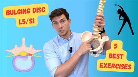 L5S1 Herniated disc relief with 3 exercises to avoid surgery