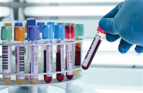 Lab Blood Sample Collection