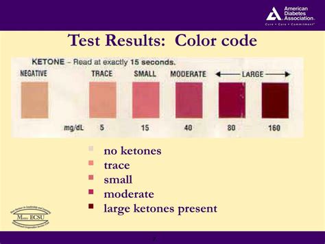 Lab Results Ketones Trace