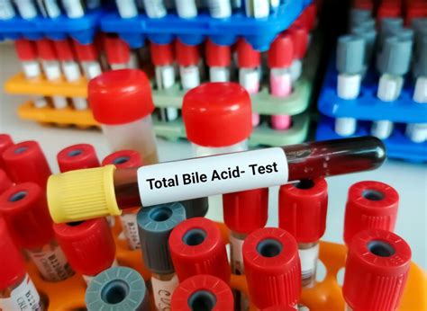 Lab Test For Bile Acids