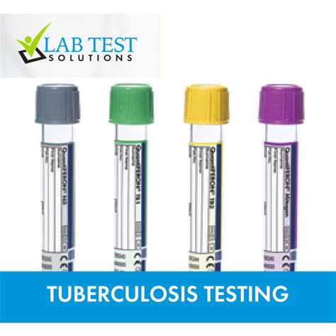 Understanding Lab Test TB: Accurate Diagnosis Explained