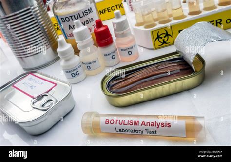 lab tests for botulism toxin