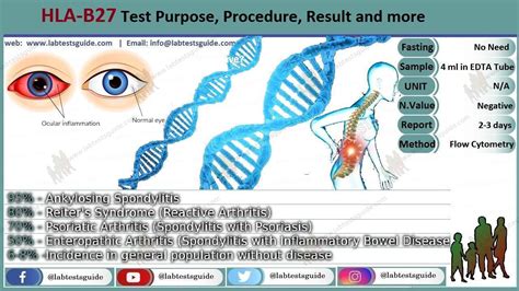 Labcorp Test Code Hla B27