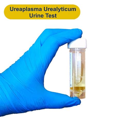 Labcorp Ureaplasma Urine