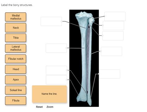label the bony structures