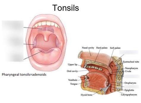 label the following different tonsils.
