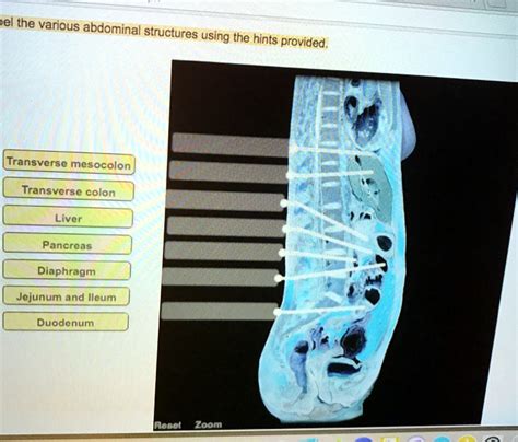 label the various abdominal structures using the hints provided