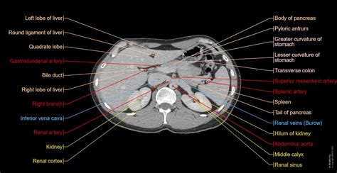 Labeled Ct Abdomen