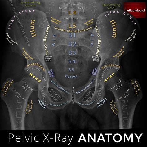 Labeled Pelvis X Ray