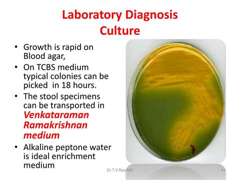 laboratory diagnosis of vibrio cholerae