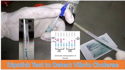 laboratory diagnosis test vibrio cholerae