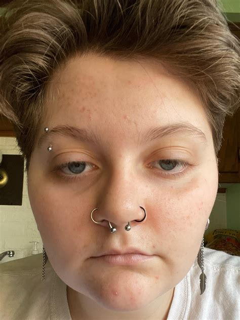 Labret Piercing Thin Lips