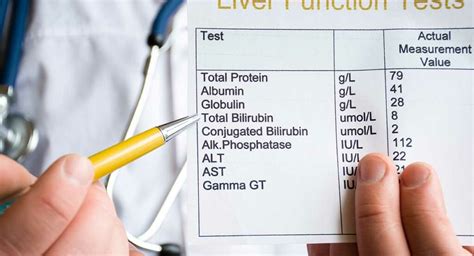 Labs That Check Liver Function