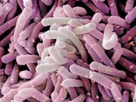 Lactobacillus Casei, Bakteri Baik yang Tinggal di Usus
