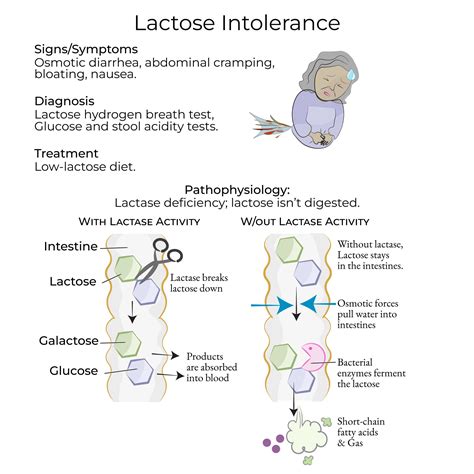 Lactose Intolerance And Flatulence
