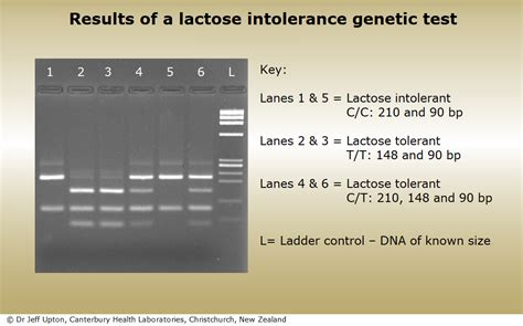 Lactose Intolerance Test Dhm