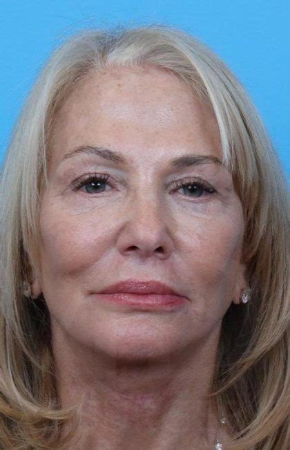 lake forest plastic surgery