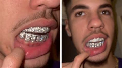 Lamelo Ball Grills