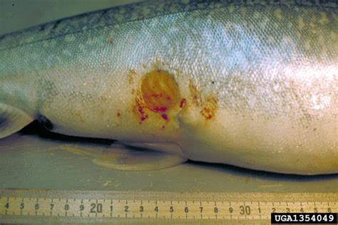 lamprey bite mark human