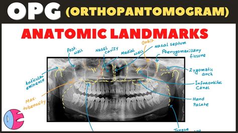 Landmarks Radiology