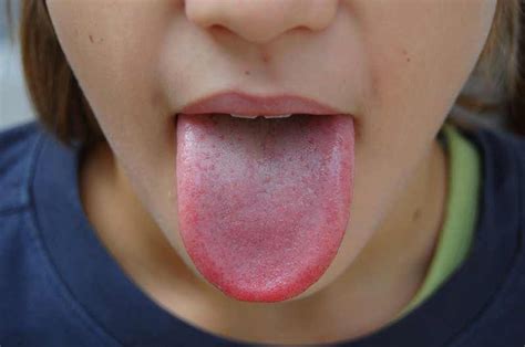 Cette couleur de langue peut révéler un cancer. Faites attention