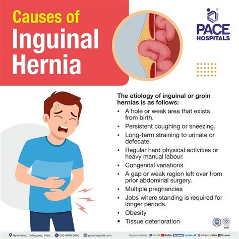 large direct inguinal hernia