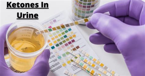 Understanding Large Urine Ketones: Causes, Risks, and What You Need to Know