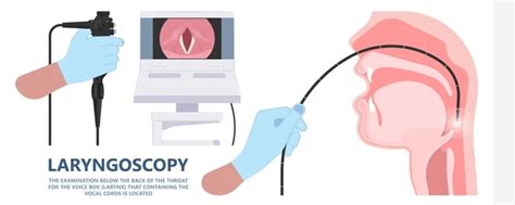 Laryngoscopy Nhs