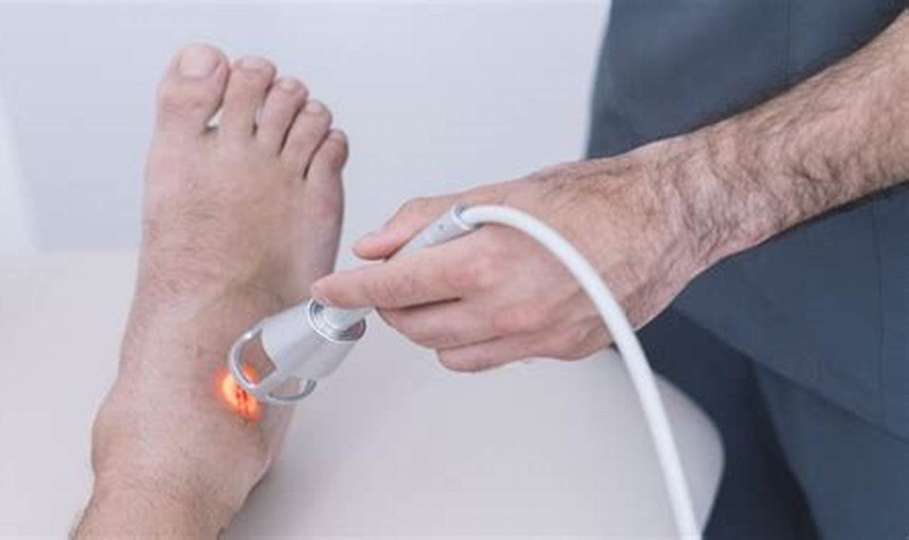 Laser Feet: A Revolutionary Advance in Laser Technology