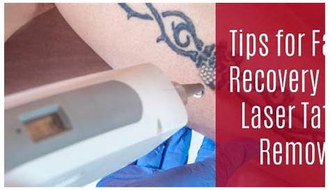 Laser Tattoo Removal Aftercare Vaseline Tips How To Heal Faster!