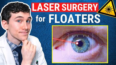 Laser Floater Removal Surgery West Boca Eye Center