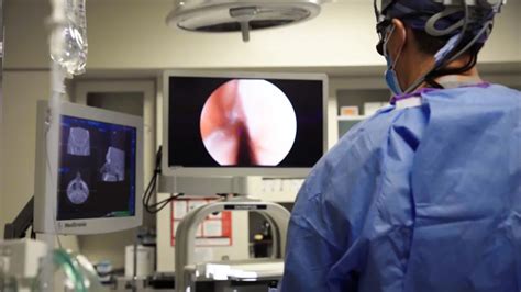 Laser Ablation Tonsils