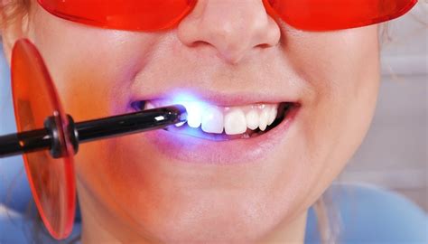 Laser Dental Extraction