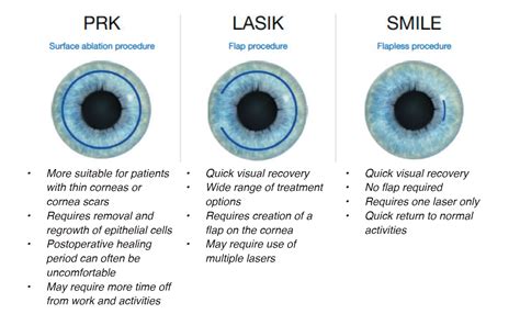 laser eye surgery comparison