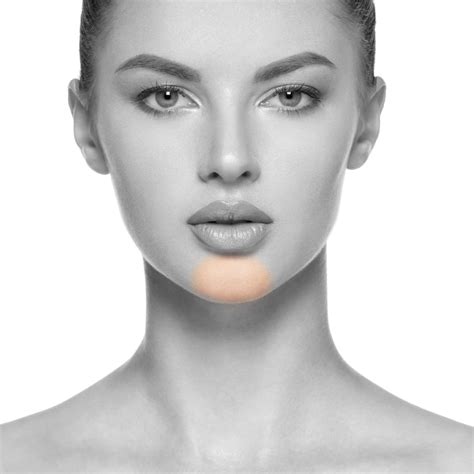laser hair removal and area around chin