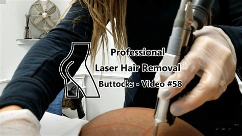 laser hair removal anus