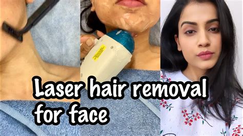 laser hair removal at home in india