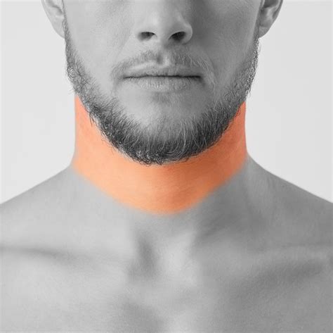 laser hair removal neck male