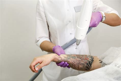 laser tattoo removal jobs near me