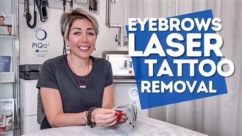 laser tattoo removal miami