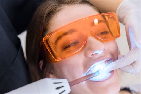 laser teeth whitening boston