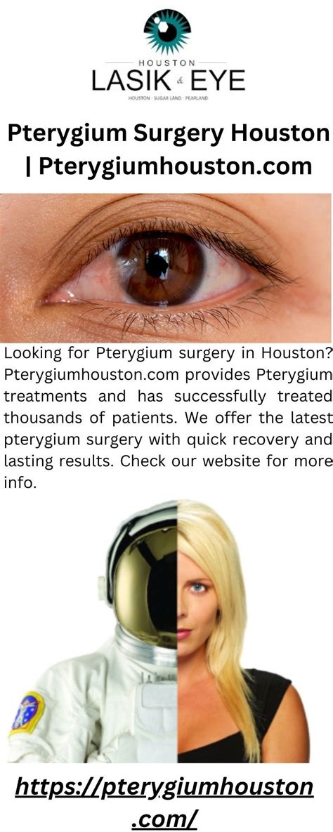 lasik eye surgery houston reviews