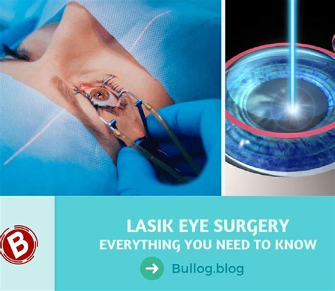 lasik eye surgery singapore