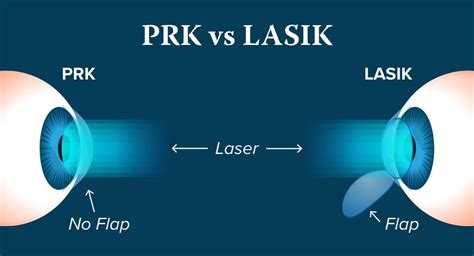 lasik eye surgery vs prk