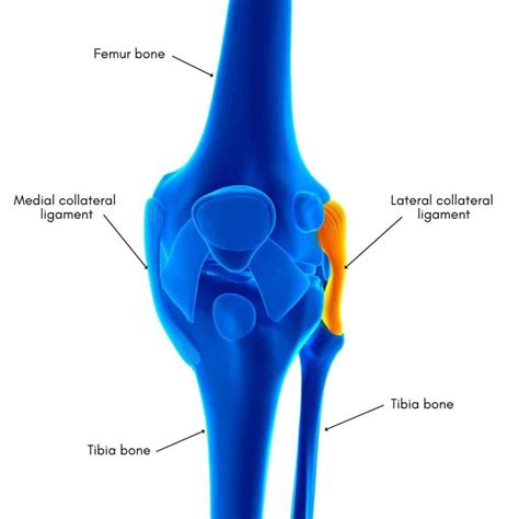 Lateral Collateral Ligament Tear: Causes, Symptoms, and Treatment Options