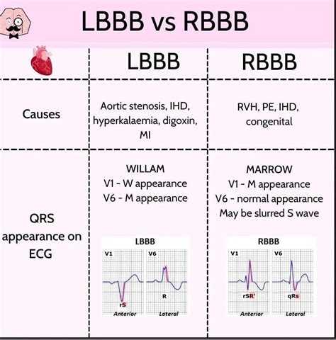 lbbb and rbbb together