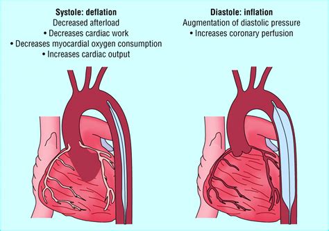 lch in cardiology